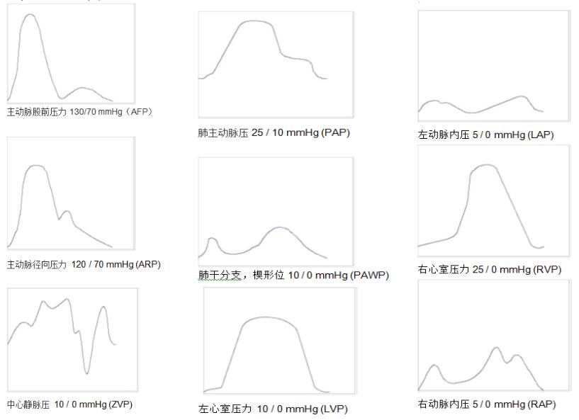 SPL 400型 體溫 心輸出量 有創(chuàng)血壓模擬器2.jpg
